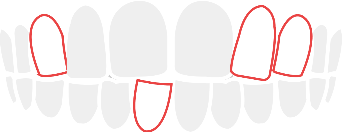 gatagata