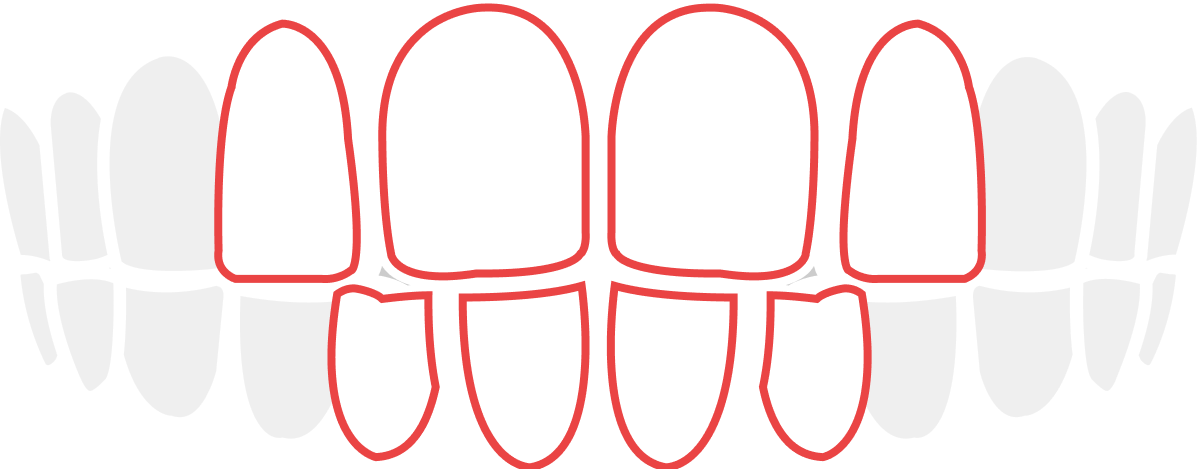 sukippa