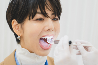 口内・歯の色をチェック